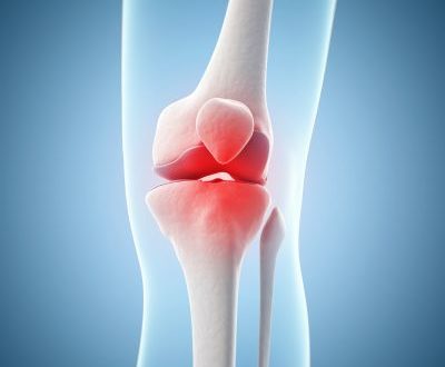 Diagram of a knee replacement surgery at KIMS Hospital, Maidstone.