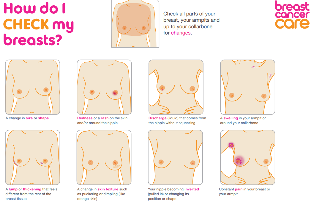 How to check your breasts for cancer