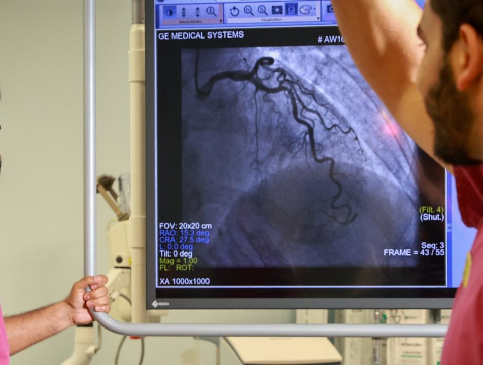 Cardiology Team working in a cath lab