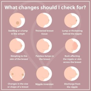 Breast symptoms to look for 