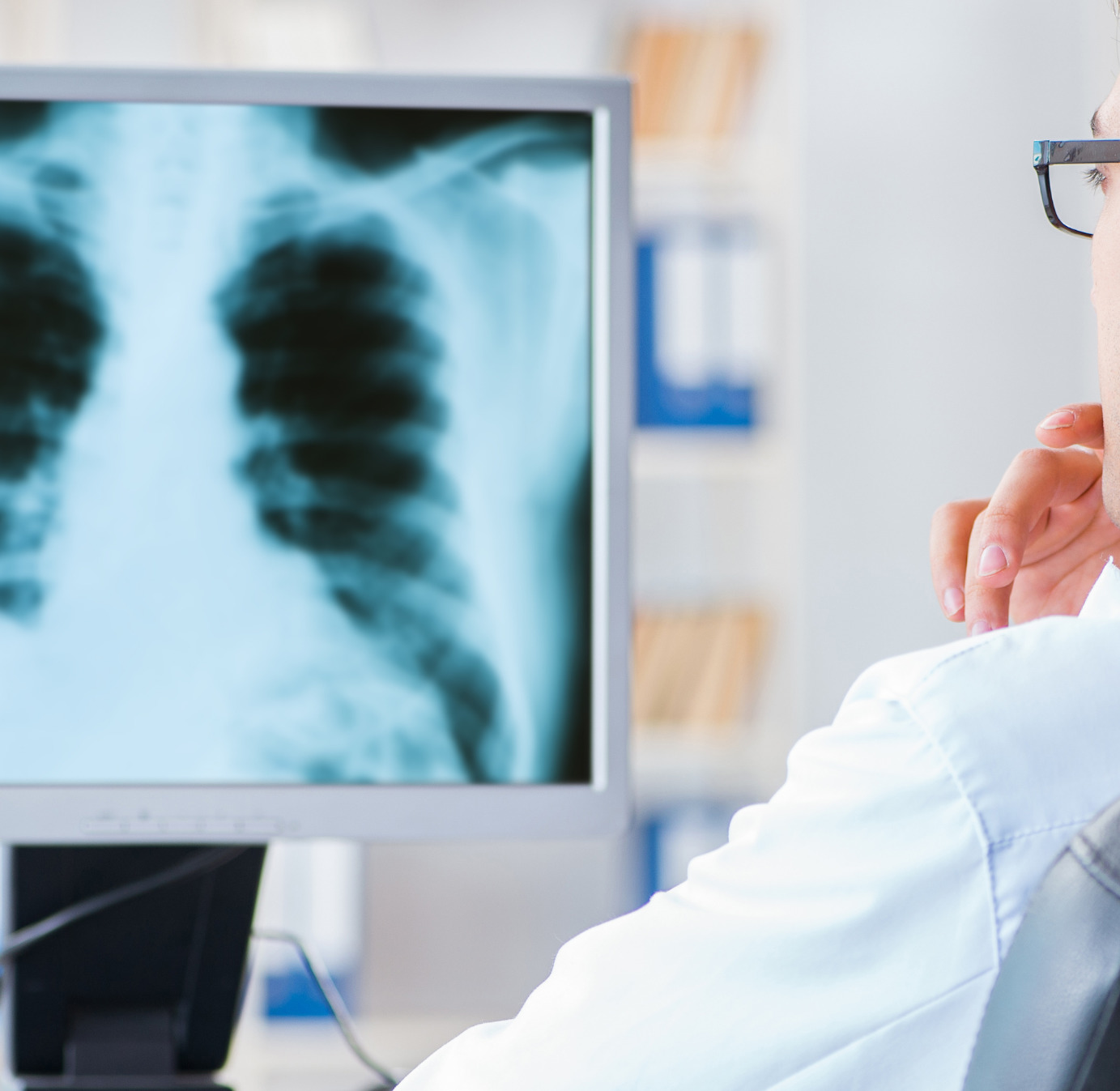 consultant analysing an x-ray of a patient's chest