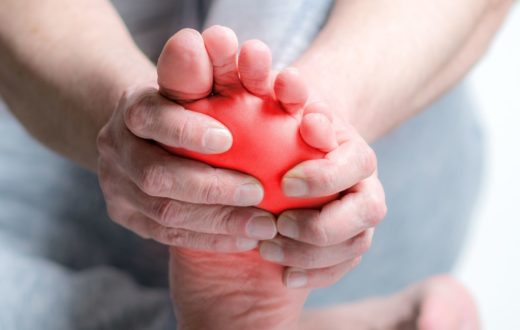 Pain from Gout, treatment and prevention advice