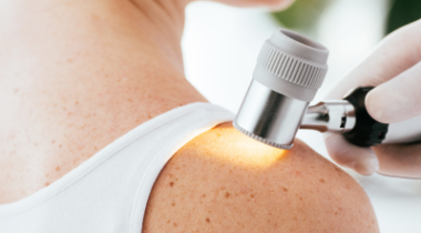 Dermatology patient having an examination.