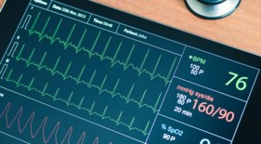 Monitor showing heart scan test results.