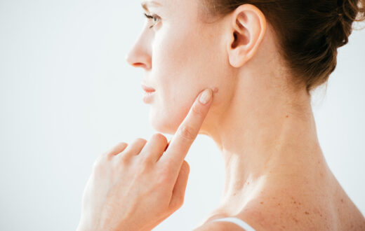 If you have noticed a new or changing mole, having the right information and guidance can help you feel more confident and in control. The ABCDE Rule is a simple guide designed to support you in recognising potential signs of Melanoma.