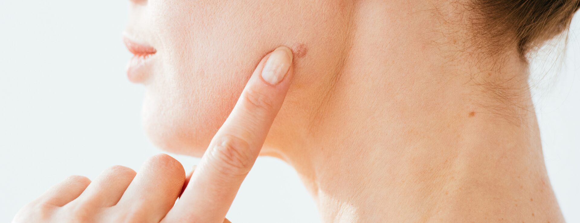 Skin cancer is one of the most common forms of cancer, and melanoma can sometimes develop without obvious symptoms at first. However, checking your skin regularly can help detect any changes early.