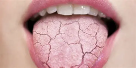 Feeling unusually thirsty throughout the day can occur when excess glucose builds up in the bloodstream. 